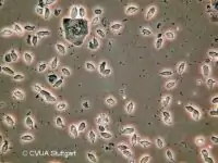Trichomonaden unter dem Mikroskop