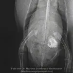 Röntgenbild - Leberentzündung Röntgenbild von Leberentzündung