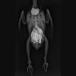 Röntgenbild von einer neuropathischer Drüsenmagenerweiterung